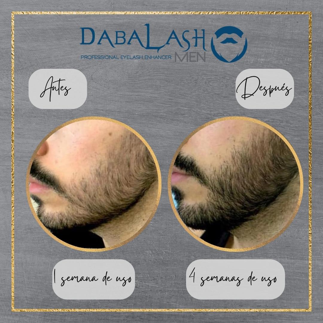 Dabalash para hombre